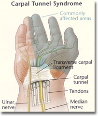 Median Nerve, Peripheral Nerve Surgery